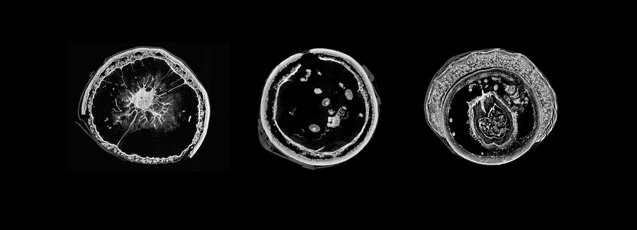 Acorn x-rays